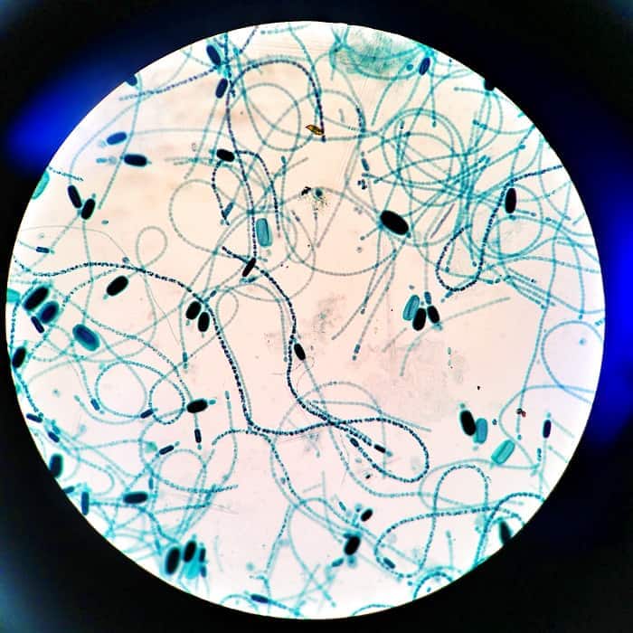 Cyanobacteria