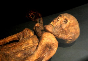 Ötzi the Iceman