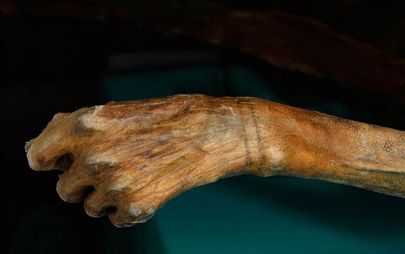 Ötzi the Iceman