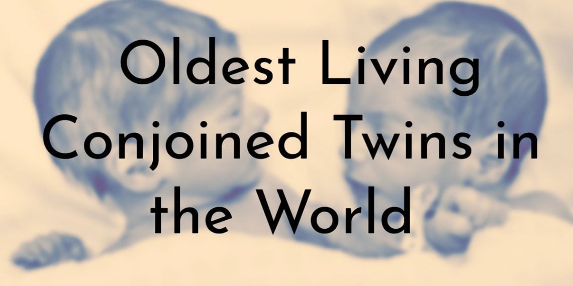 6 Oldest Living Conjoined Twins in the World