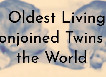 Oldest Living Conjoined Twins in the World