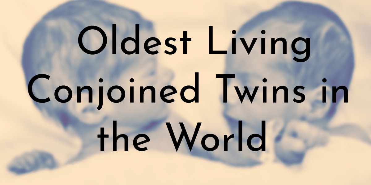 Oldest Living Conjoined Twins in the World