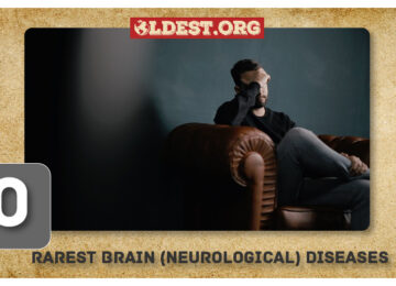 Rarest Brain (Neurological) Diseases