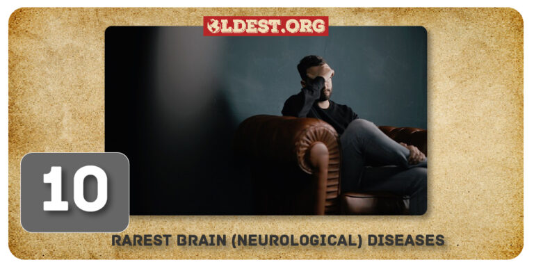 10 Rarest Brain (Neurological) Diseases In The World - Oldest.org