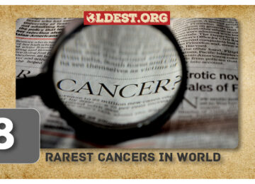 Rarest Cancers in World