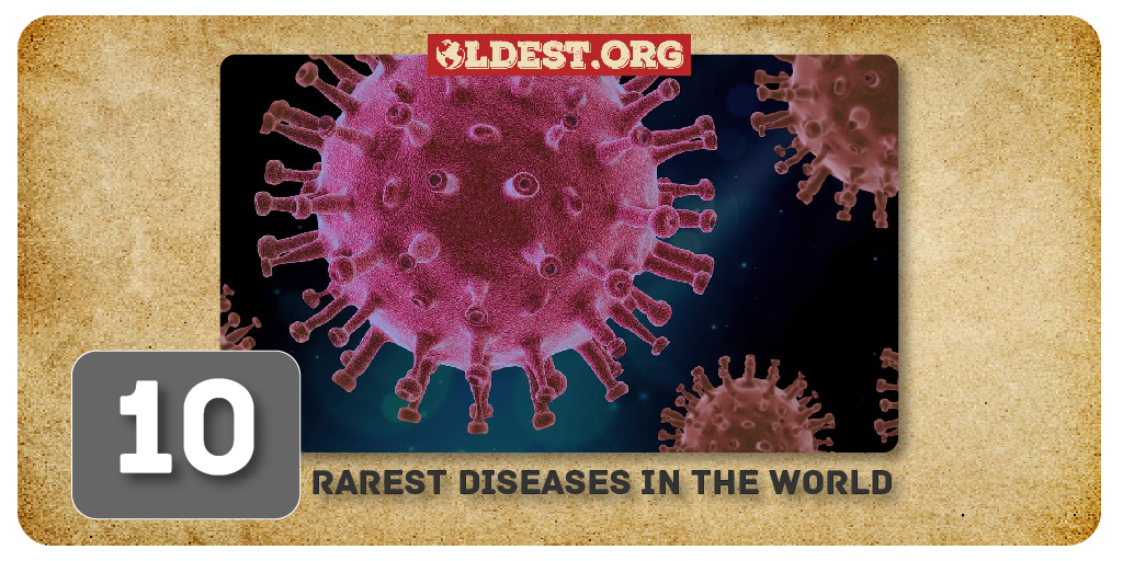 Rarest Diseases In The World