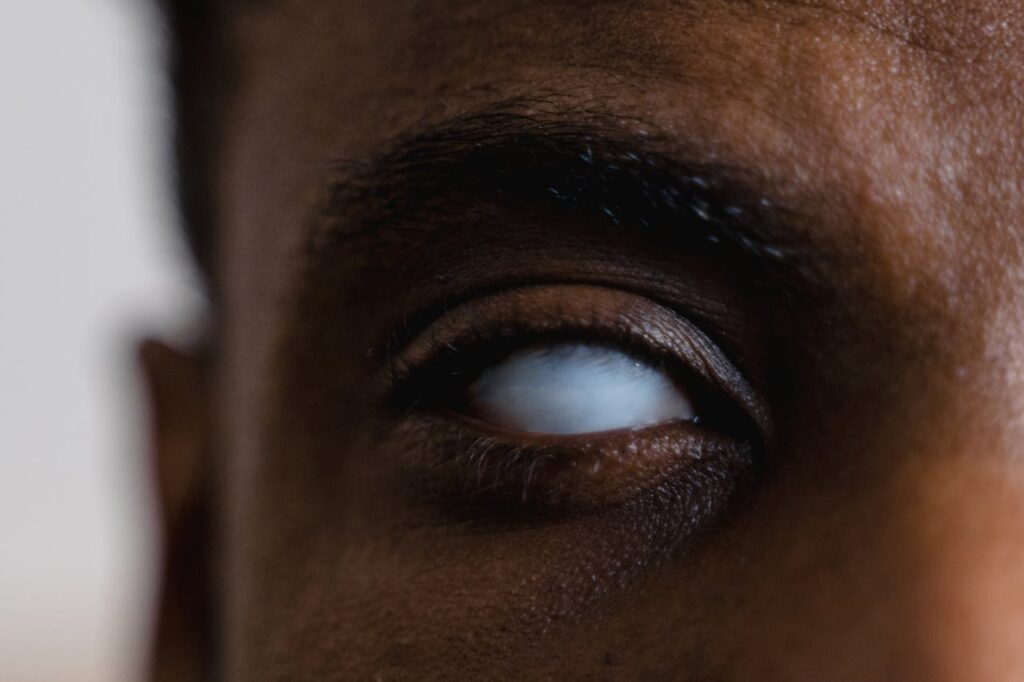 Ribose-5-Phosphate Isomerase Deficiency