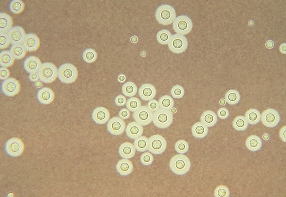 Cladosporium sphaerospermum